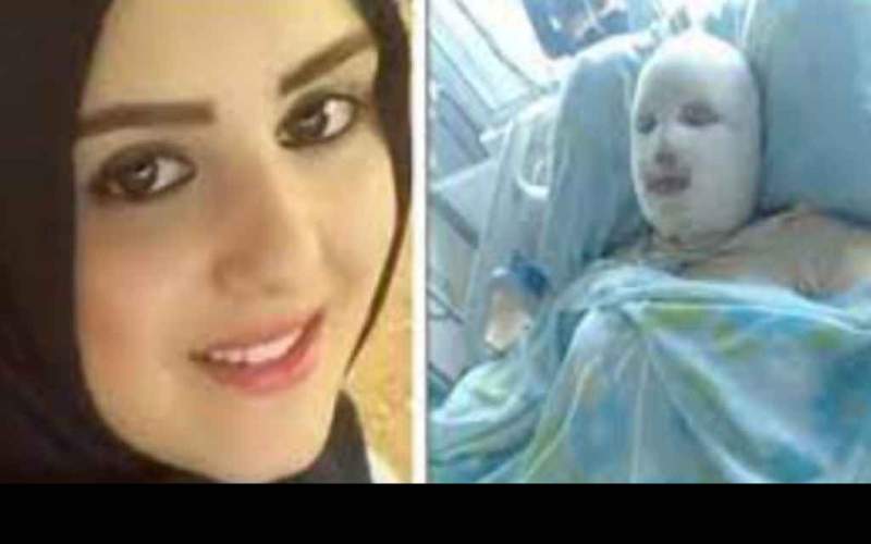 العنف الأسري يلاحق نساء لبنان.. مآس ضرب وحرق وتهديد بالذبح